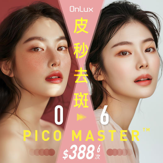 pico 超皮秒激光去斑